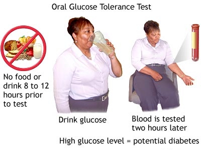Oral Glucose Tolerance test